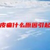 头皮痛什么原因引起的(07/04更新)