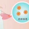 烂嘴角是怎么回事(07/05更新)